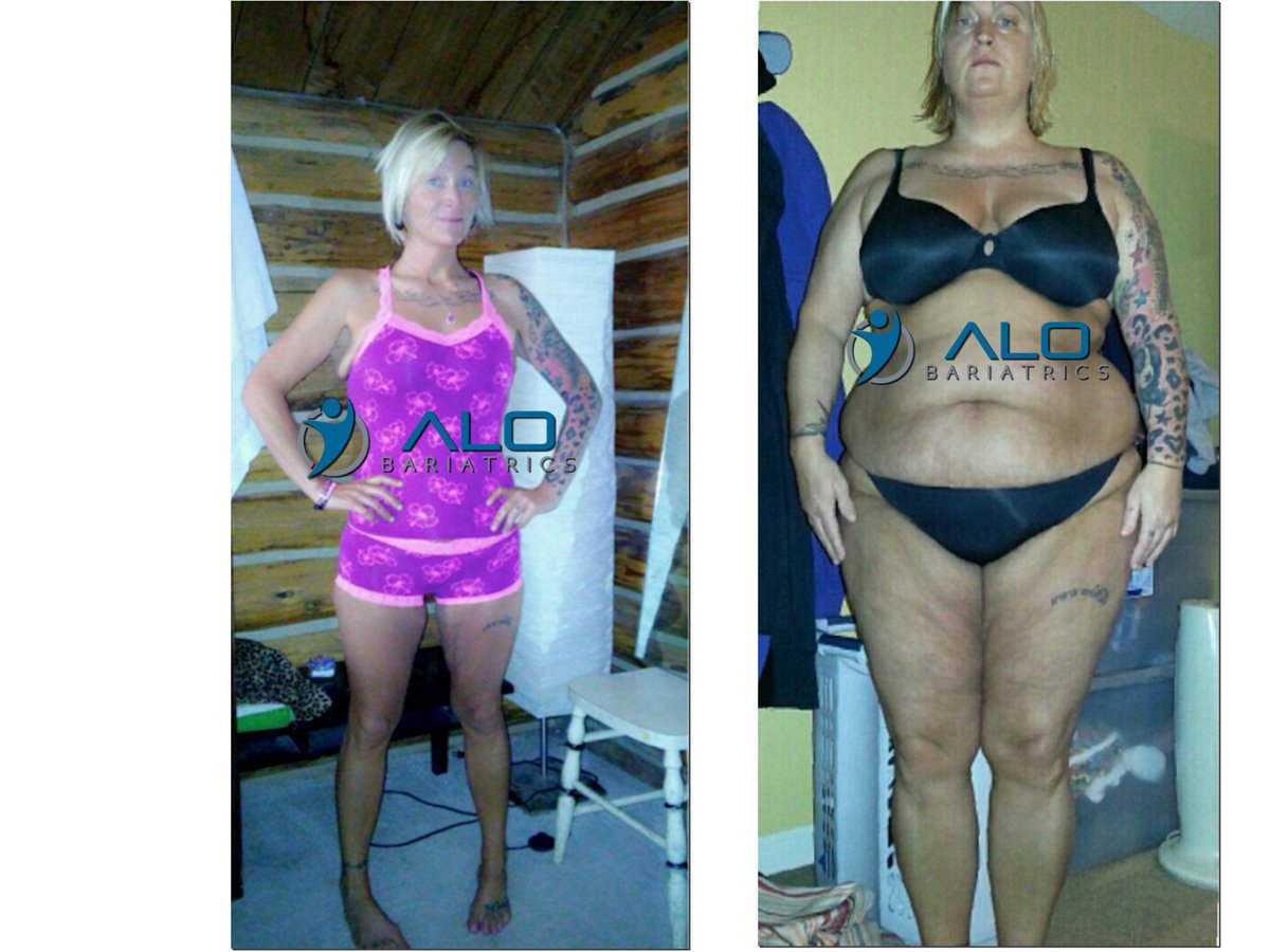 ALO Bariatrics — photo 3