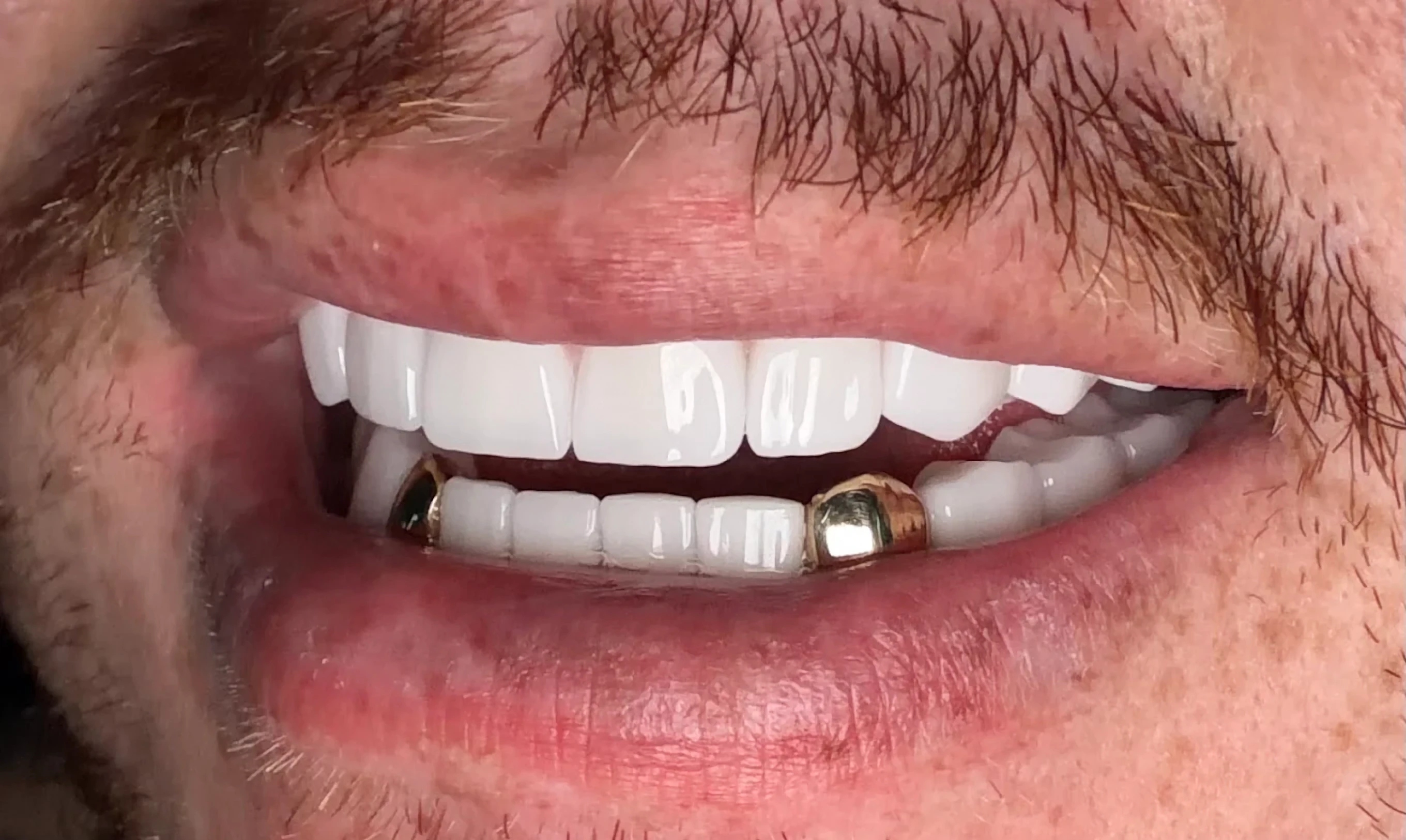 Lema Dental Clinic — photo 12